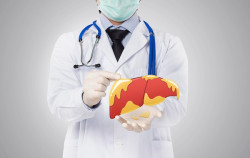 doctor showing fatty liver , liver disease in white background