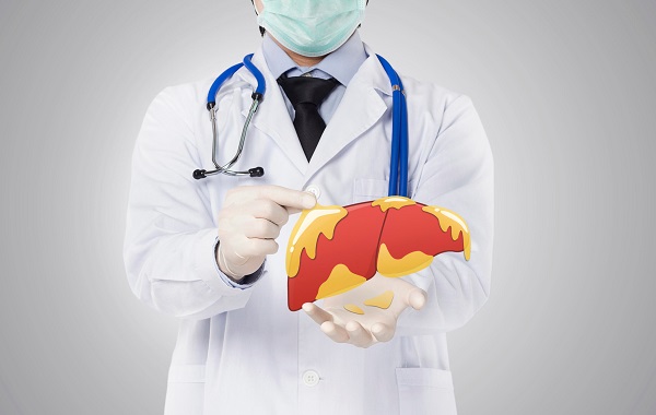 doctor showing fatty liver , liver disease in white background